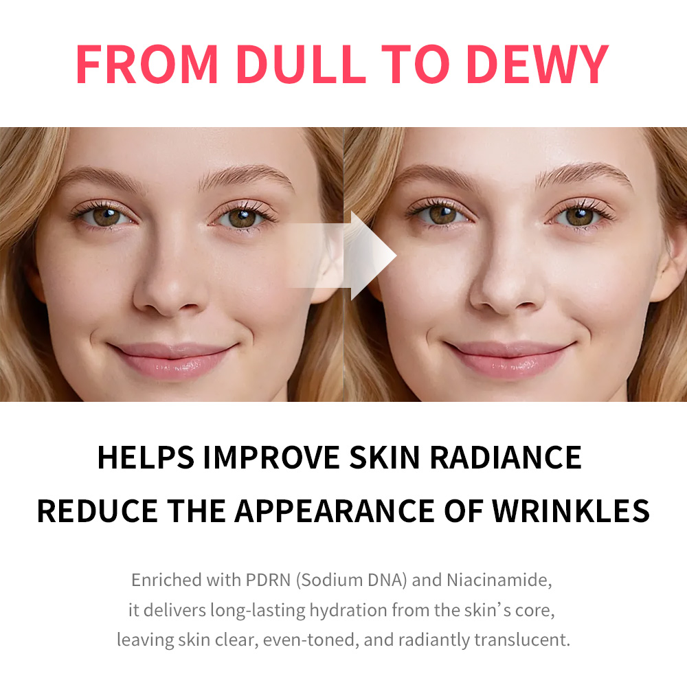 PDRN Pink Niacinamide Milky To - Echinacea ulasan dan harga